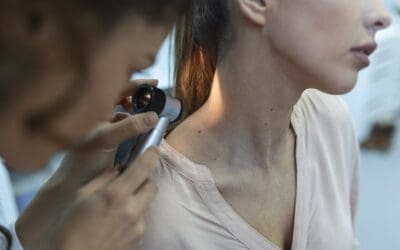 Controllo dei nei: prevenzione e diagnosi precoce del melanoma